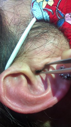 How to Safely Pierce Your Ear at Home