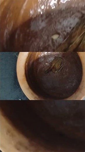 #Kunda Ela Clean Cheyali | Easy & Simple Cleaning Method🌻