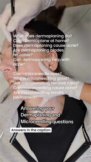 Dermaplaning & microneedling… the questions I get all the time 👀 Let’s clear a few things up ⬇️ 1️⃣ What does dermaplaning do? Removes dead skin peach fuzz, boosts glow, helps products sink in better and leaves skin smooth smooth ✨ 2️⃣ Can I dermaplane at home? You can… but home tools do not equal professional blades, technique or hygiene. That’s where problems start 👀 3️⃣ Does dermaplaning cause acne? No – when done properly. Poor technique or dirty blades absolutely can though. 4️⃣ Are derma
