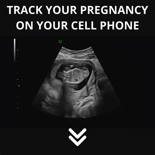 Free ultrasound app that answers common little questions 🔍 | BraApps