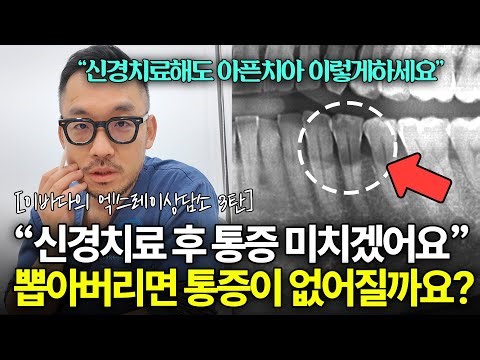 통증 없어질때까지 치아 하나씩 신경치료 하자는데.. 이게 맞나요..? l 이바다의 엑스레이 상담소 3탄
