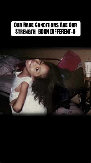 Living with a Halo: My Journey with Muscular Dystrophy