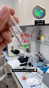 Positive coombs test at our lab! #مختبرات #علم الدم #نقل الدم | علم التحليلات المرضية