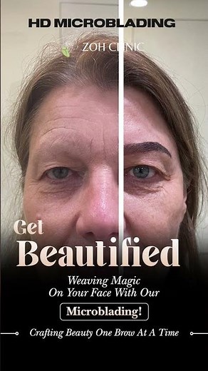 Microblading Explained | Graphical Brow Transformation at Zoh Aesthetic Clinic Hyderabad