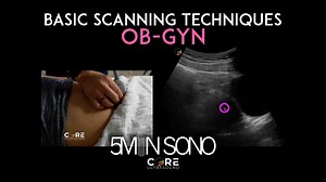 Basic OB/Gyn Scanning Technique (2024)