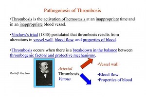 Pathogenesis of Thrombosis - SlideServe