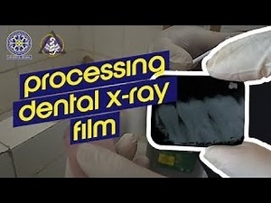 Periapical Dental X-Ray Film Processing