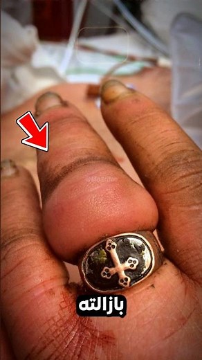 هذا ما سيحدث لك إذا لم تنتبه ؟😲💀