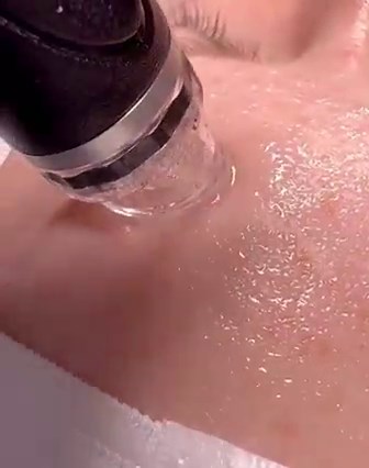 Results that speak for themselves  • • • #hydrafacial #hydrafacialtreatment | Zeeman's | Facebook