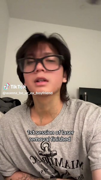 Laser Removal of Adam's Apple: Transform Your Neck