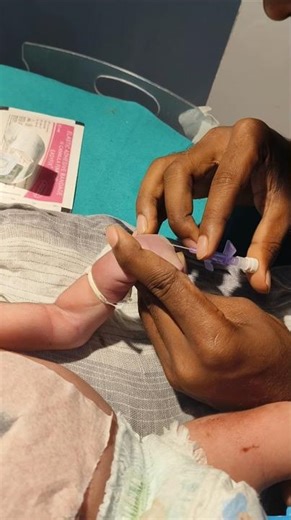 Jelco insertion Tricks New born baby 🐥🍼#baby #hospital