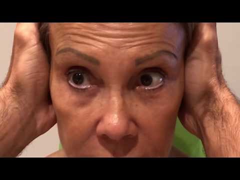 Halmagyi Test o Head Impulse Test: Neurotomía vestibular