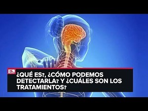 Punto y coma: Esclerosis múltiple