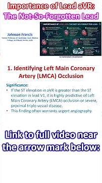 Importance of Lead aVR: The Not-So-Forgotten Lead