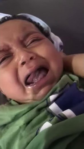 case 428 what's the treatment of Ranula, mucocele? sublingual salivary glands, DD(dermoid cyst,HPV)