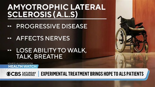 It's estimated about 35,000 people in the United States are living with ALS, also known as Lou Gehrig's Disease.There is no cure. but there might be real progress in preventing it. CBS News Chief Medical Correspondent @DrLaPook has that story.