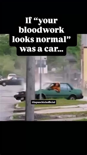 1.6K views · 10K reactions | The 1985 Toyota Corolla that runs on the gas lights for daysssss #lupus #spoonie #chronic #autoimmune | LupusChick.com - Autoimmune Health and Support Community | Facebook
