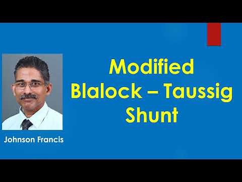 Modified Blalock – Taussig Shunt