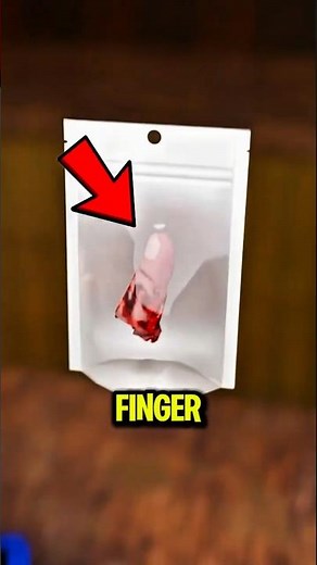 If You Ever Cut Off a Finger, Do This Immediately 😳