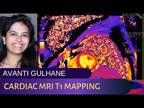 TMT: Cardiac MRI: Value of T1 Mapping by Dr Avanti Gulhane