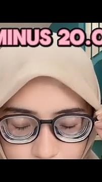 High Myopia girl With Glasses -20.00 #glasses #hyperopia #myopia #myopie #strongglasses #myopic