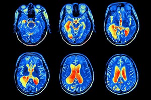 Cognitive Science and Religious Faith: What (if anything) should Christian Theology learn from the Cognitive Science of Religion | Faraday Institute for Science and Religion
