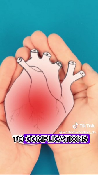 Understanding Rodent Trichinosis: Symptoms, Treatment, and Prevention