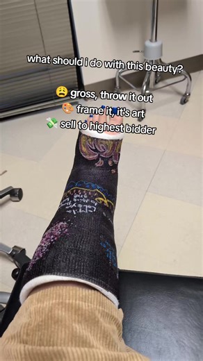 Saying Goodbye to My Decorated Leg Cast