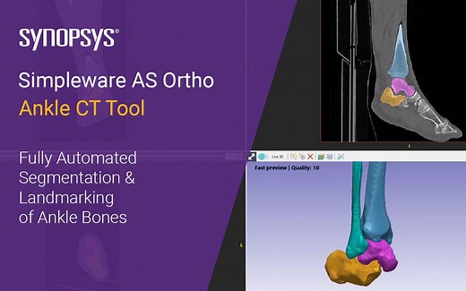 【Simpleware】骨科自动化分割 AS Ortho 模块应用---踝关节 CT