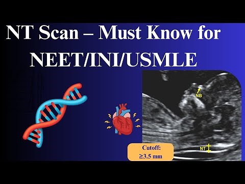 Mastering Nuchal Translucency Scans: High-Yield Tips for NEET PG, INI-CET & USMLE OBGYN Success!📚