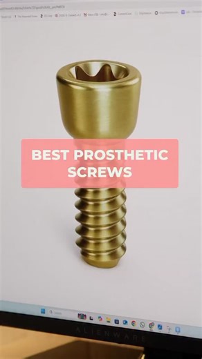 Chameleon Digital Dental Lab on Instagram: "There are so many prosthetic screws on the market with many more added daily. Adam discusses which ones he recommends. • • #allonx #dds #dmd #oralsurgeons #prosthodontist"