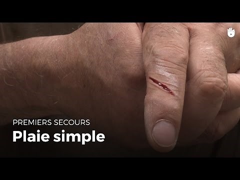 First Aid: Simple Wound | First Aid