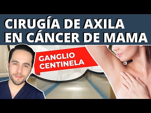 CIRUGÍA DE AXILA en CÁNCER DE MAMA - Biopsia de GANGLIO CENTINELA