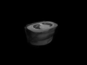 Unity Engine - Real-Time Computarized Tomography DICOM 3D Rendering in Virtual Reality