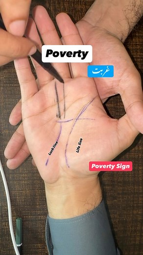 Poverty prediction in hand |life line| | Asad Raza -AR Palmistry Numerology
