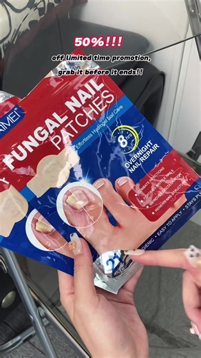 “Nail fungus?FIXED with these easy-care patches! “ #tiktok #tiktokshop #fyp #fypシ #gamechangers #footcaretips #beautyhacks #fungalfix #nomorehiding #nailtok