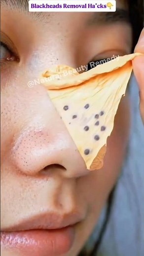 Blackheads gone in minutes! ✨Easy home remedy for clear, smooth nose 👃#BlackheadsRemoval #ytshorts