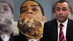 4.4M views · 33K reactions | Tras ser diagnosticado con un enorme Osteosarcoma en su mandíbula, los médicos le dieron a este joven y a su familia nulas posibilidades de sobrevivir, pero una revolucionaria intervención quirúrgica podría salvarle la vida ¿Dará resultado?六⚠‍⚕ #MiCuerpoMiDesafio | Discovery Latinoamérica | Facebook