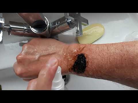 Easy way to remove Bitumen/tar paint from your skin