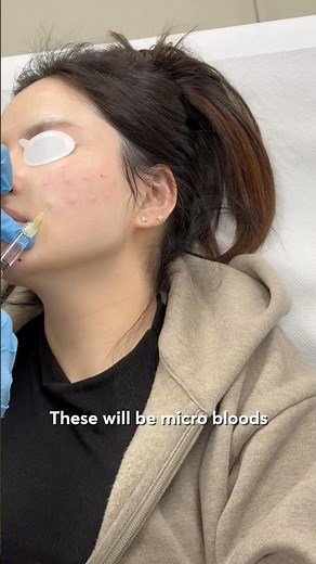 How Polynucleotides Rebuild Damaged Skin From Inside Out