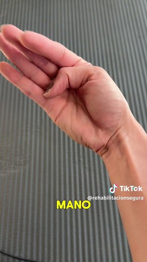 Tratamiento ideal para la tenosinovitis de De Quervain