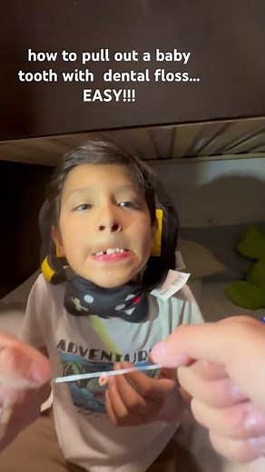 How to pull out a baby tooth with dental floss, very easy and simple tut #viralvideo #4upage #tooth