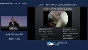Arthroscopic Management of Partial Thickness Rotator Cuff Tears: Repair in Situ