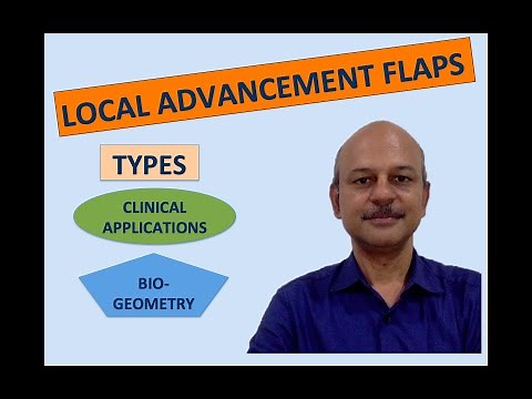#Localflaps Advancement flaps