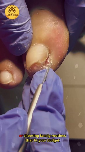 2.4K views · 12 reactions | Ep.21 Wellness-driven nail care + cardio nutrition meal prep for beginners at home  #CardioHealth #SmartEating #HealthyLiving | LOS A-T BOYZ | Facebook