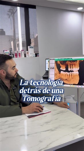 Hoy te mostramos una tomografía… y por qué es tan importante. En Deo Clinic, la tecnología es parte fundamental de tu seguridad y tu resultado. Con la tomografía podemos: 🔍 Ver exactamente dónde hay hueso 🎯 Planear tu cirugía antes de tocar tu boca 💻 Crear una cirugía guiada digital con precisión milimétrica 🛡️ Reducir riesgos, tiempos y molestias Es como “hacer la cirugía” primero en la computadora… para que cuando llegue el día real, todo salga perfecto. ✨ Más tecnología = mejores resultad