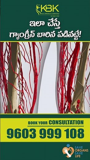 What Causes Gangrene | How To Treat Gangrene | Dr.Aishwarya | KBK Hospitals #gangrene