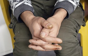 What It's Like to Be an Addict – and Homeless