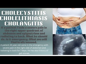 Acute Cholecystitis ultrasound | Acute cholangitis ultrasound | Gallstones ultrasound | cholelithias