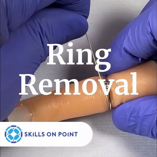 Learn how to remove your patients seemingly stuck ring 👀💍😲✋ | Nursing and NCLEX Mastery